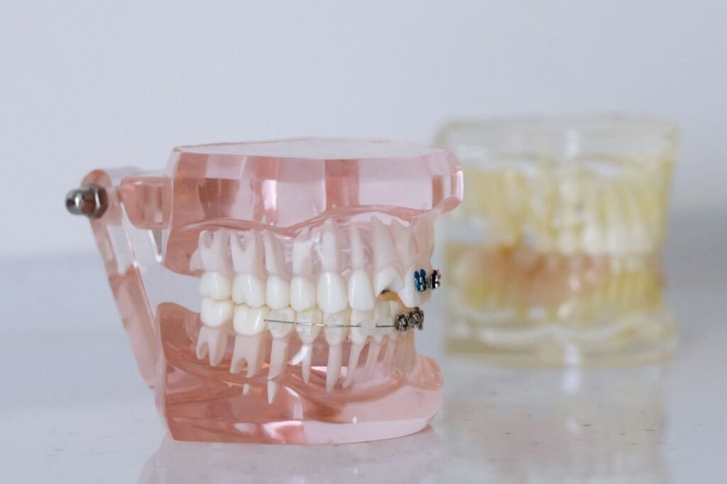 Dental models comparing fixed braces and clear aligners — orthodontics in Dombivli
